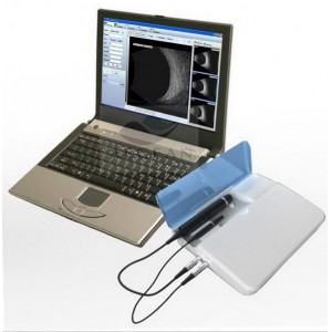 AG-BU006 easy carrying high quality CE& ISO eye test ultrasound