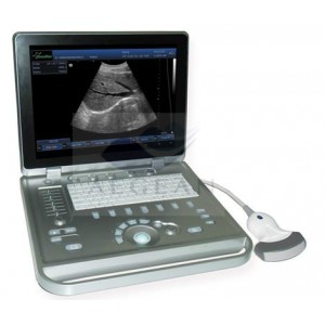 AG-BU009 carrying hospital Handheld portable ultrasound scanner